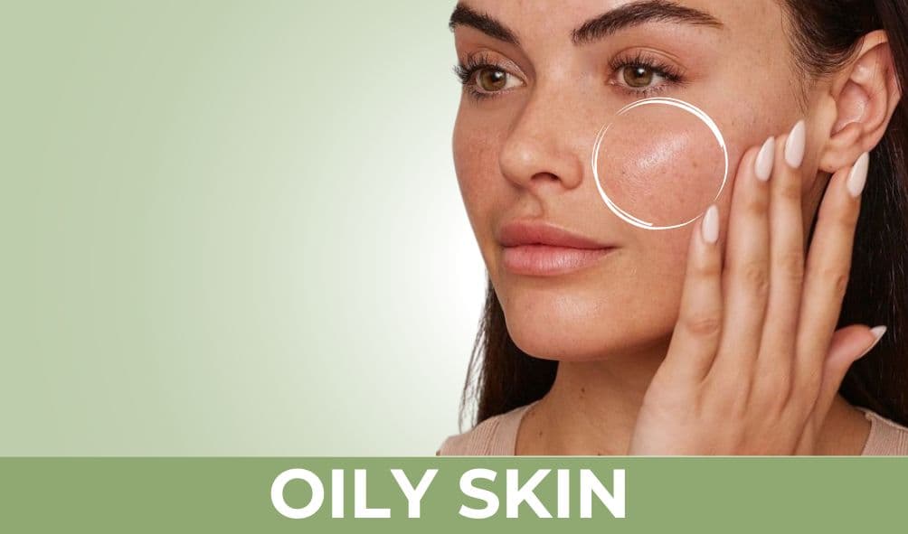 Oily Skin