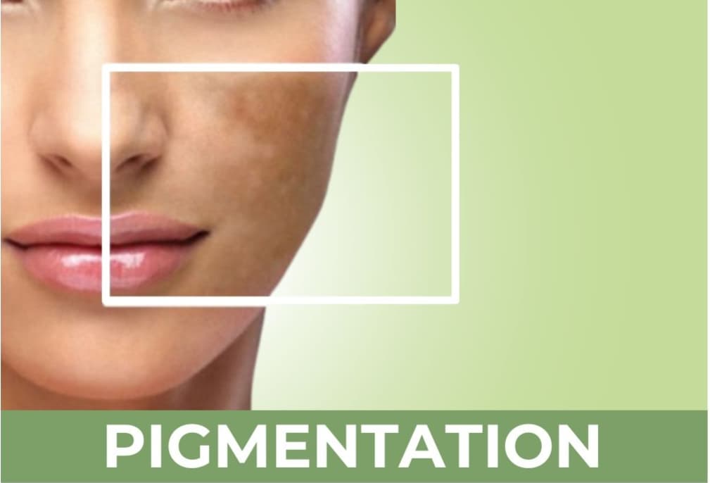 Pigmentation