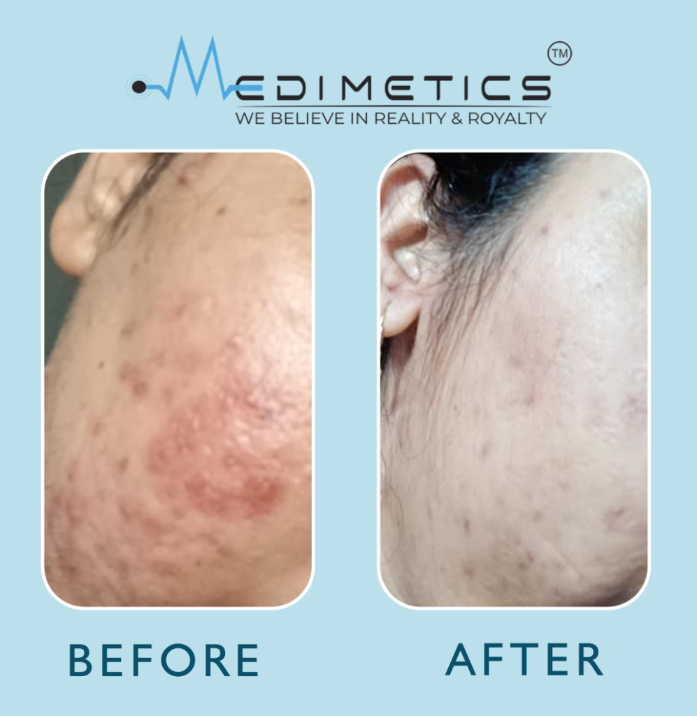 Before & After Result 1